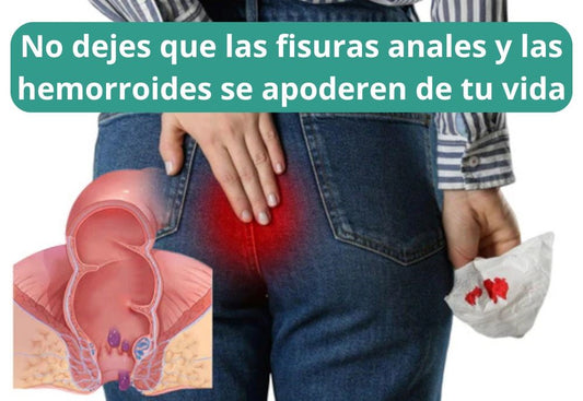 Herbal Hemorrhoid Cream